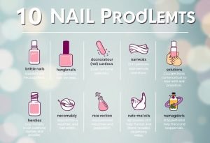 fixing 10 common nail problems at home etd | newinbeauty-studios | Kingston beauty Salon